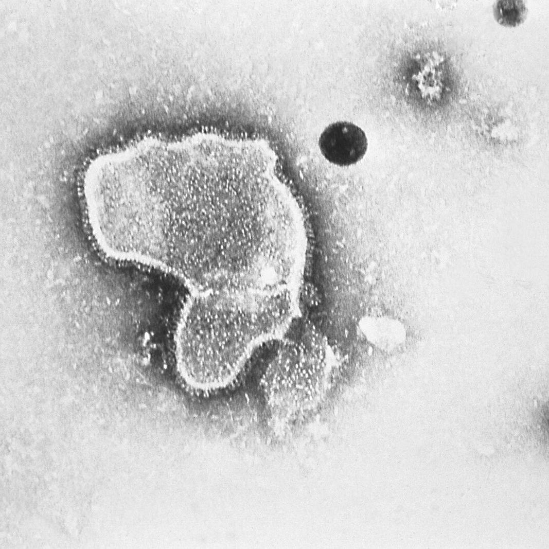 FDA approves first vaccine for RSV, a moment six decades in the making